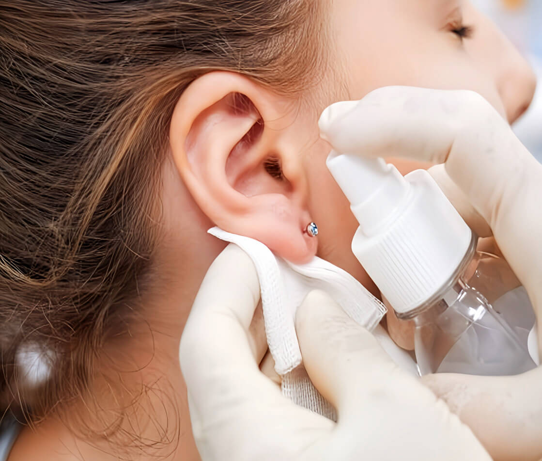 medical ear piercing